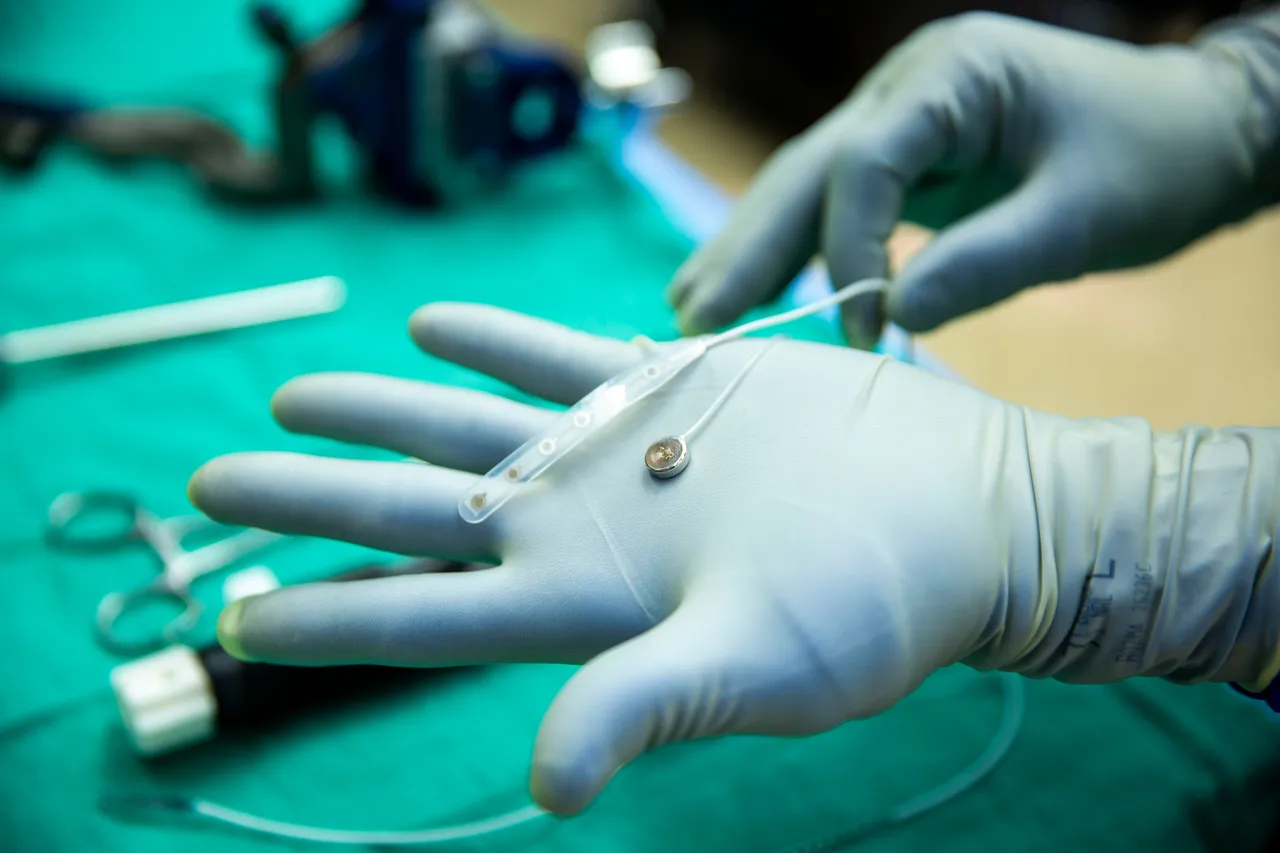 Paradromics: Đơn vị thứ 2 sau Neuralink thử nghiệm lâm sàng chip kết nối não với máy tính trên người
