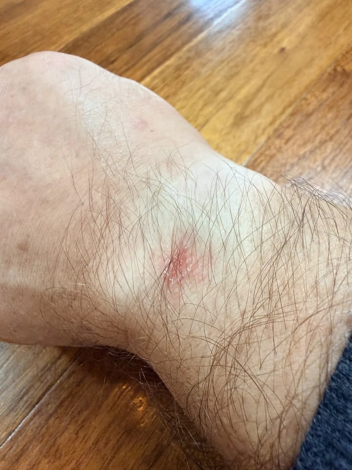 Một số người dùng Apple Watch Series 12 và Ultra 4 phản ánh tình trạng kích ứng da khi đeo các...